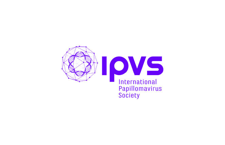 IPVS-100